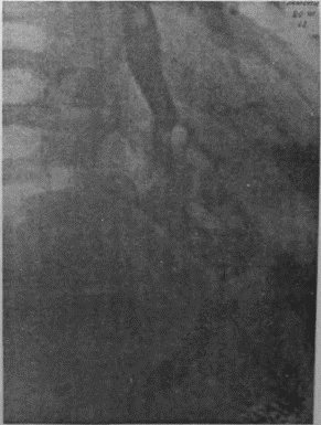 Иллюстрация к книге — Этюды желудочной хирургии [i_126.jpg]