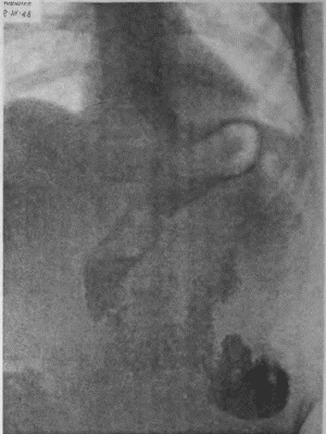 Иллюстрация к книге — Этюды желудочной хирургии [i_128.jpg]