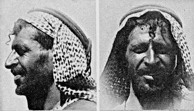 Иллюстрация к книге — Расы Европы [_214.jpg]