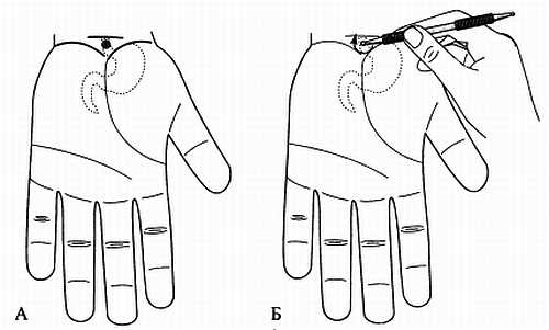 Иллюстрация к книге — Сам себе Су Джок доктор [_115.jpg]