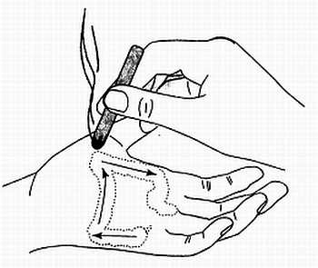 Иллюстрация к книге — Сам себе Су Джок доктор [_124.jpg]