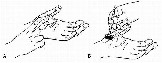 Иллюстрация к книге — Сам себе Су Джок доктор [_71.jpg]