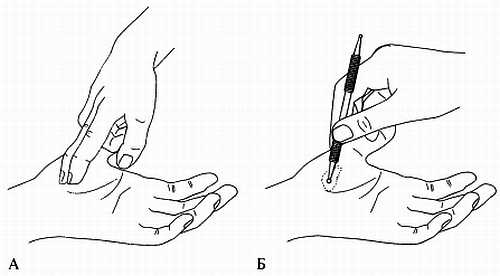 Иллюстрация к книге — Сам себе Су Джок доктор [_97.jpg]