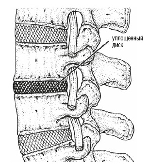 Иллюстрация к книге — Настольная книга для тех, у кого болит спина [i_004.jpg]
