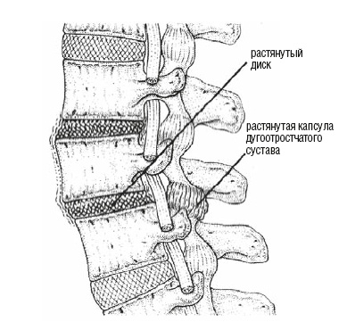 Иллюстрация к книге — Настольная книга для тех, у кого болит спина [i_008.jpg]
