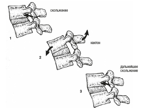 Иллюстрация к книге — Настольная книга для тех, у кого болит спина [i_028.jpg]