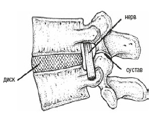 Иллюстрация к книге — Настольная книга для тех, у кого болит спина [i_029.jpg]