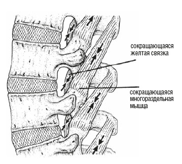Иллюстрация к книге — Настольная книга для тех, у кого болит спина [i_033.jpg]
