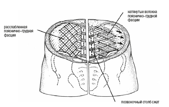 Иллюстрация к книге — Настольная книга для тех, у кого болит спина [i_035.jpg]