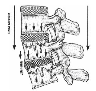 Иллюстрация к книге — Настольная книга для тех, у кого болит спина [i_037.jpg]