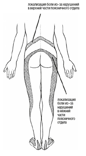 Иллюстрация к книге — Настольная книга для тех, у кого болит спина [i_041.jpg]