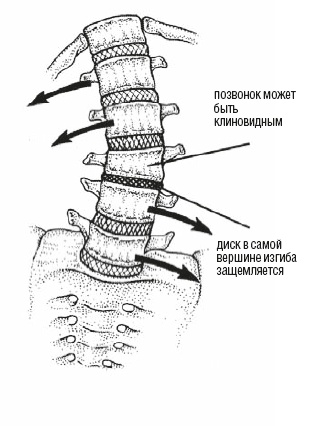Иллюстрация к книге — Настольная книга для тех, у кого болит спина [i_043.jpg]