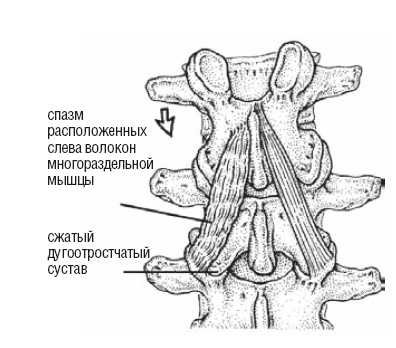 Иллюстрация к книге — Настольная книга для тех, у кого болит спина [i_070.jpg]
