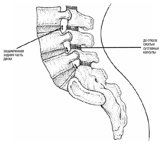 Иллюстрация к книге — Настольная книга для тех, у кого болит спина [i_075.jpg]