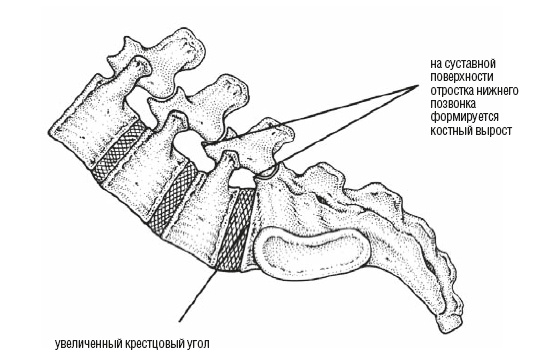 Иллюстрация к книге — Настольная книга для тех, у кого болит спина [i_077.jpg]