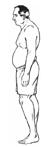 Иллюстрация к книге — Настольная книга для тех, у кого болит спина [i_078.jpg]