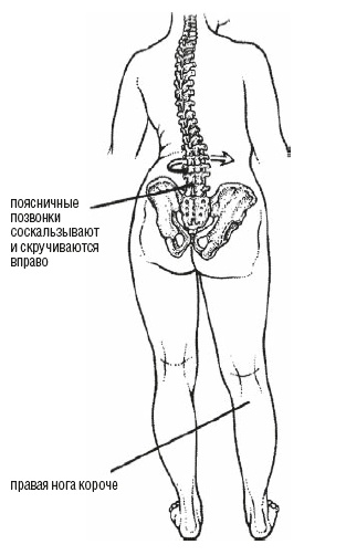 Иллюстрация к книге — Настольная книга для тех, у кого болит спина [i_079.jpg]