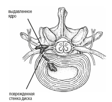 Иллюстрация к книге — Настольная книга для тех, у кого болит спина [i_134.jpg]