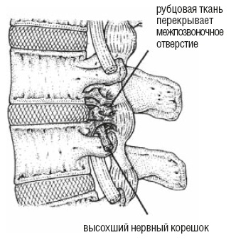 Иллюстрация к книге — Настольная книга для тех, у кого болит спина [i_139.jpg]