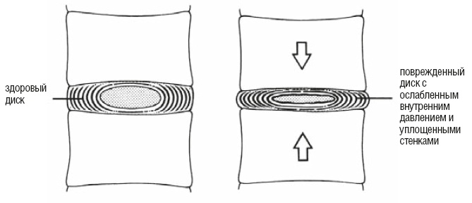 Иллюстрация к книге — Настольная книга для тех, у кого болит спина [i_140.jpg]