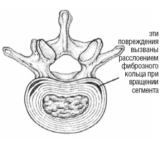 Иллюстрация к книге — Настольная книга для тех, у кого болит спина [i_142.jpg]