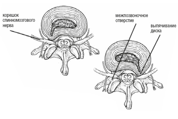 Иллюстрация к книге — Настольная книга для тех, у кого болит спина [i_143.jpg]
