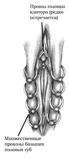 Иллюстрация к книге — Энциклопедия Пирсинга. Настольная книга мастера и клиента [multiplegenitalw.jpg]