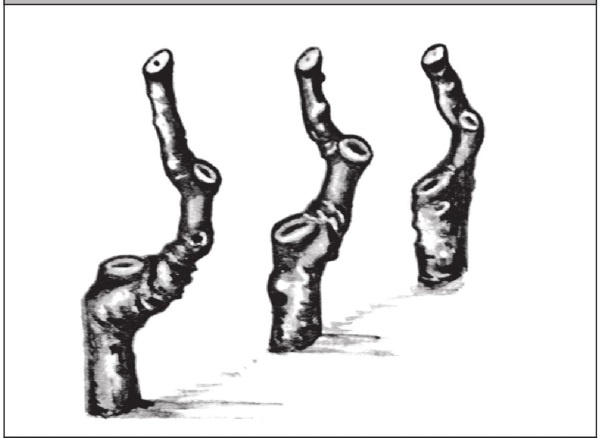 Иллюстрация к книге — Формирование и обрезка садовых деревьев [i_002.jpg]