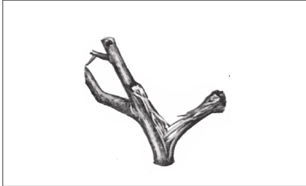 Иллюстрация к книге — Формирование и обрезка садовых деревьев [i_005.jpg]