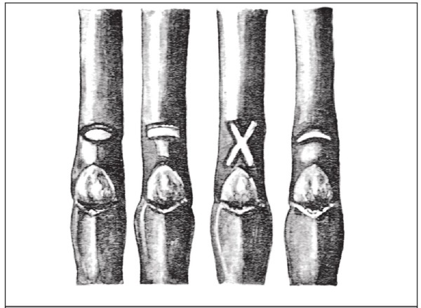 Иллюстрация к книге — Формирование и обрезка садовых деревьев [i_089.jpg]