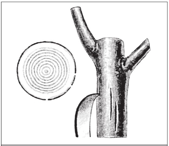 Иллюстрация к книге — Формирование и обрезка садовых деревьев [i_095.jpg]
