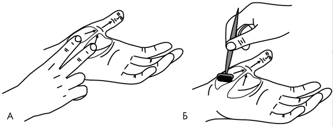 Иллюстрация к книге — Су-Джок лечит. Мигрень, кашель, боль в спине, тяжесть в желудке [i_037.jpg]