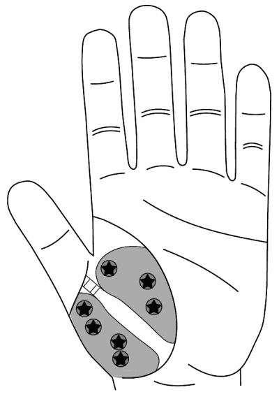 Иллюстрация к книге — Су-Джок лечит. Мигрень, кашель, боль в спине, тяжесть в желудке [i_044.jpg]