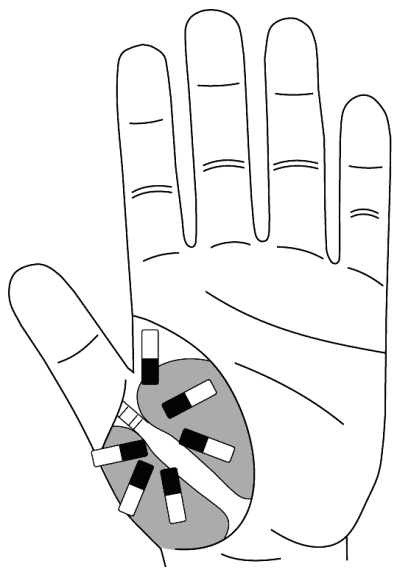 Иллюстрация к книге — Су-Джок лечит. Мигрень, кашель, боль в спине, тяжесть в желудке [i_045.jpg]