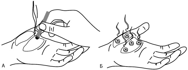 Иллюстрация к книге — Су-Джок лечит. Мигрень, кашель, боль в спине, тяжесть в желудке [i_046.jpg]