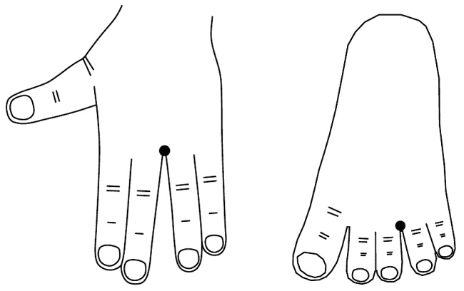 Иллюстрация к книге — Су-Джок лечит. Мигрень, кашель, боль в спине, тяжесть в желудке [i_072.jpg]