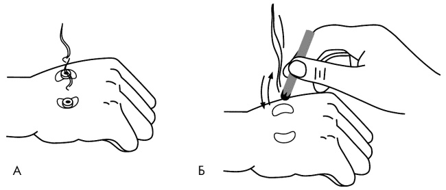 Иллюстрация к книге — Су-Джок лечит. Мигрень, кашель, боль в спине, тяжесть в желудке [i_077.jpg]