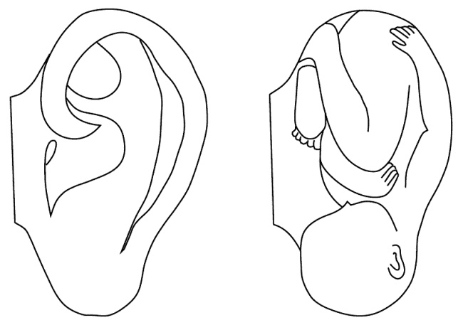 Иллюстрация к книге — Су-Джок лечит. Мигрень, кашель, боль в спине, тяжесть в желудке [i_091.jpg]