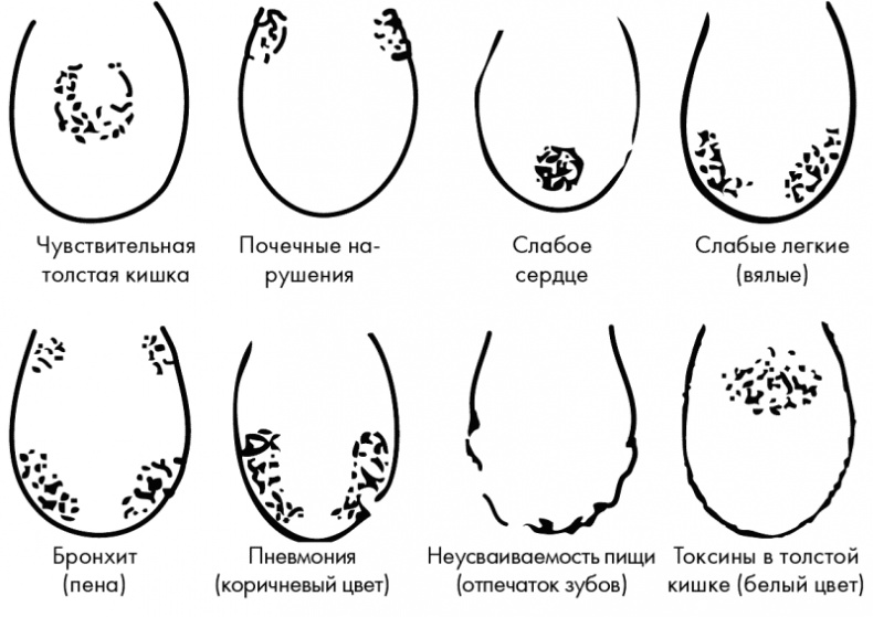 Иллюстрация к книге — Су-Джок лечит. Мигрень, кашель, боль в спине, тяжесть в желудке [i_098.jpg]