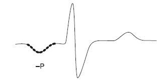 Иллюстрация к книге — Что показывает кардиограмма [i_007.jpg]
