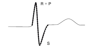 Иллюстрация к книге — Что показывает кардиограмма [i_008.jpg]