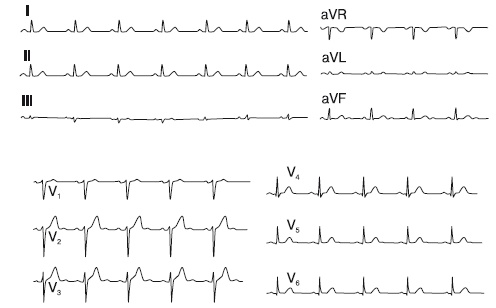 Иллюстрация к книге — Что показывает кардиограмма [i_016.jpg]