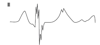 Иллюстрация к книге — Что показывает кардиограмма [i_017.jpg]