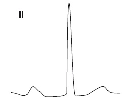 Иллюстрация к книге — Что показывает кардиограмма [i_020.jpg]
