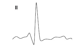 Иллюстрация к книге — Что показывает кардиограмма [i_021.jpg]