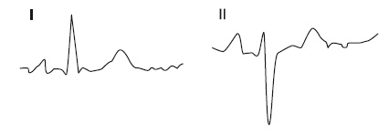 Иллюстрация к книге — Что показывает кардиограмма [i_024.jpg]