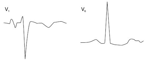 Иллюстрация к книге — Что показывает кардиограмма [i_026.jpg]
