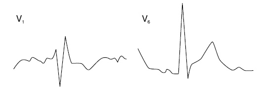 Иллюстрация к книге — Что показывает кардиограмма [i_027.jpg]