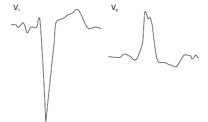 Иллюстрация к книге — Что показывает кардиограмма [i_029.jpg]