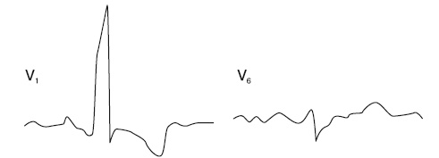 Иллюстрация к книге — Что показывает кардиограмма [i_033.jpg]